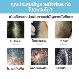 ยาสระผมผมร่วง ยาสระผมขจัดรังแค แชมพูควบคุมน้ำมัน 500ml คุมความมันลดผมร่วง หนังศรีษะสดชื่น ผมนุ่มสลวยแข็งแรง