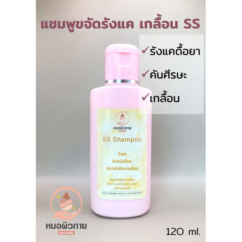 แชมพูขจัดรังแค SS ขจัดรังแคเรื้อรัง เกลื้อน แบรนด์:หมอผิวกาย
