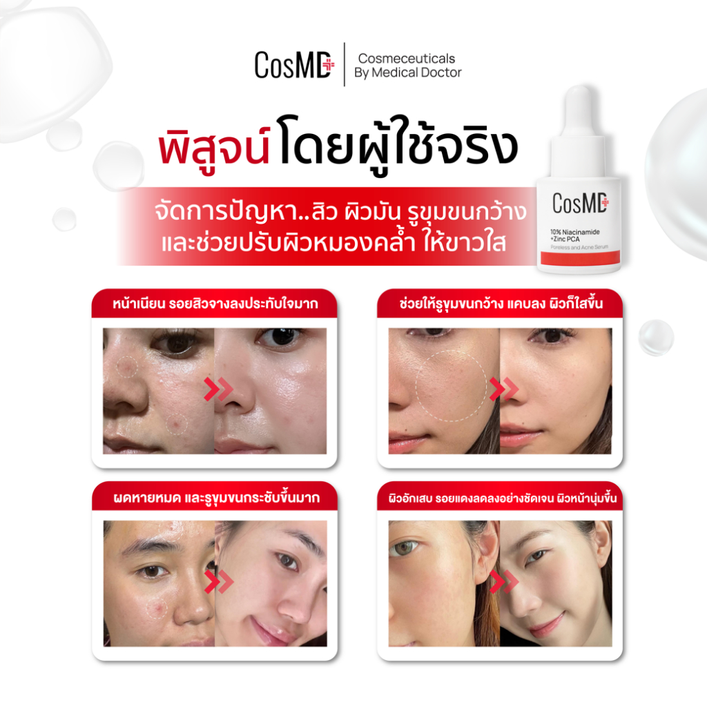 CosMD ลดหมองคล้ำ ลดสิว ผิวกระจ่างใส ผสม 10% Niacinamide + Zinc PCA