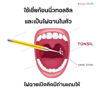 นิ่วทอลซิล อุปกรณ์กำจัดนิ่วทอมซิล ก้อนเหม็นในปากนิ่วทอนซิล อุปกรณ์ครบใช้ง่าย tonsil stone remover ไฟฉายมีถ่านให้ครบ NEW