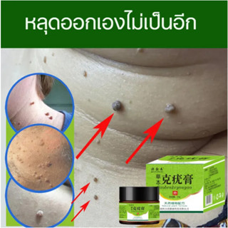 【มีสต๊อกในไทย】ครีมกำจัดหูด ยาทาหูด 20g ยาทาหูด ผลิตภัณฑ์ไฝ ขี้แมลงวัน หูดตาปลาและติ่งเนื้อ ปลอดภัยไม่เจ็บ กำจัดรวด