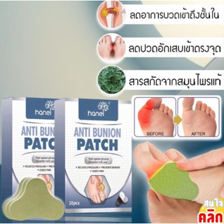 Hanel Anti bunion patch แผ่นแปะเท้าสมุนไพรลดปวดบวม