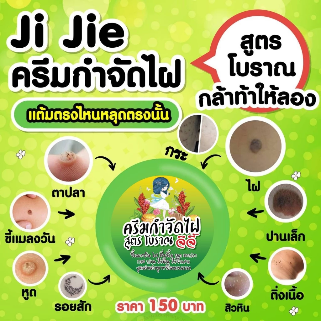 [ของแท้] ครีมไฝจีจี้ ขี้แมลงวัน ติ่งเนื้อ หูด ตาปลา แก้ปัญหา สิวหิน ครีมแต้มไฝจีจี้ ไฝ หูด จี้ไฝ แต้มไฝ