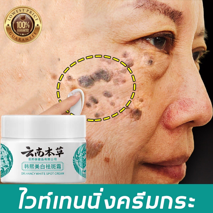 【ลดกระหน่ำ】Hanxi ครีมแก้ฝ้ากระ 20g ครีมแก้ฝ้าถาวร ครีมทาฝ้ากระ ซ่อมแซมฟื้นฟูผิว ดูกระจ่างผิวใส ทาฝ้าหนาลึก ครีมกน้าขาวใส