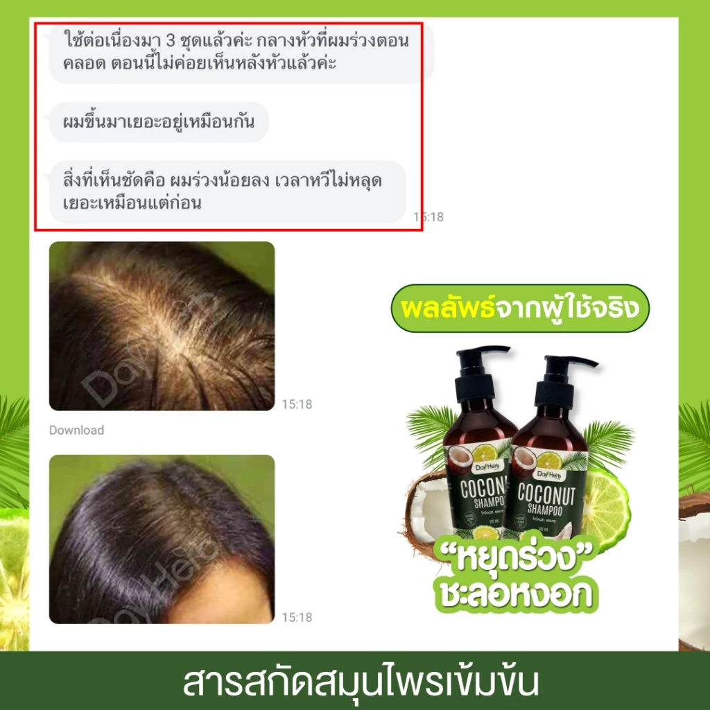 แชมพูมะพร้าว เดย์เฮิร์บ ลด ผมร่วง ผมบาง thumbnail 5