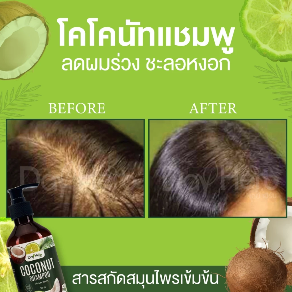 แชมพูมะพร้าว เดย์เฮิร์บ ลด ผมร่วง ผมบาง thumbnail 9