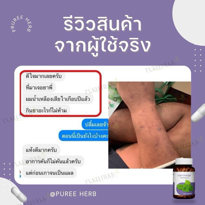 พลูคาวแคปซูล ตราภูรี - จบทุกปัญหาผิวหนัง - รูปที่ 7
