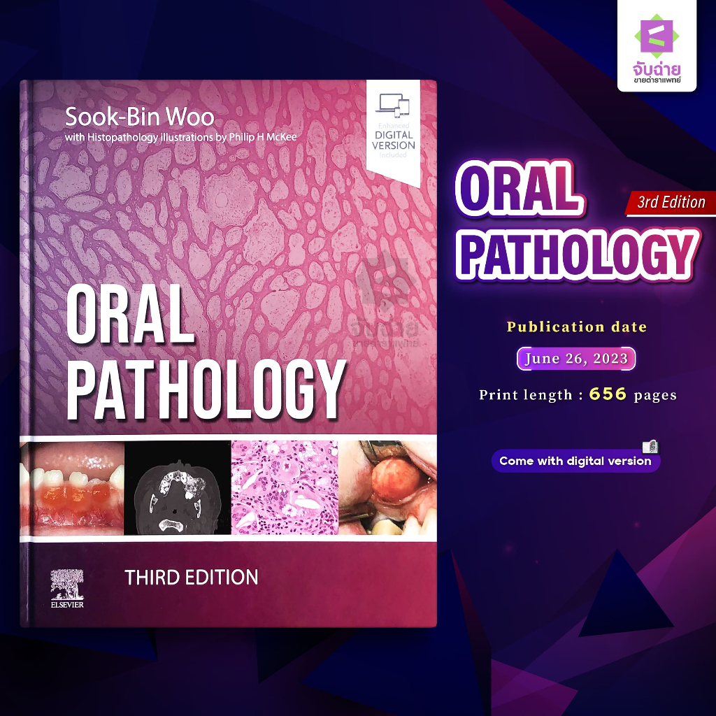 Oral Pathology 3rd Edition