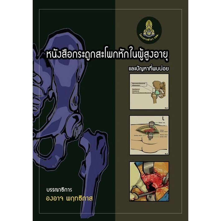 c111 กระดูกสะโพกหักในผู้สูงอายุและปัญหาที่พบบ่อย 9786166049084