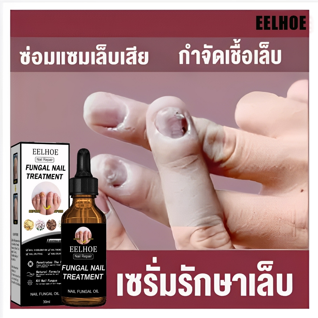 ของแท้ 100% EELHOE เซรั่มบำรุงเล็บ น้ำยาบำรุงเล็บ 30ml บำรุงเล็บ ต่อต้านการติตเชื้อรา ซ่อมแซมเล็บแตก เล็บเปราะ เล็บหนา