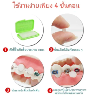 ขี้ผึ้งสำหรับคนจัดฟัน ตลับละ 5 แท่ง พร้อมส่ง (ขั้นต่ำ5ชิ้น)