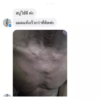 ของแท้!! สบู่ว่านและเหงือกปลาหมอ D-Derma สูตรดั่งเดิมโดยเภสัชกร