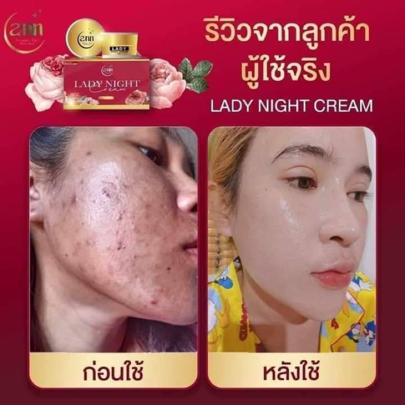 เชตครีมเชตหน้าใส เชต 2 ชิ้น เลดี้ไนท์ +วิตามินหน้าใส - รูปที่ 3