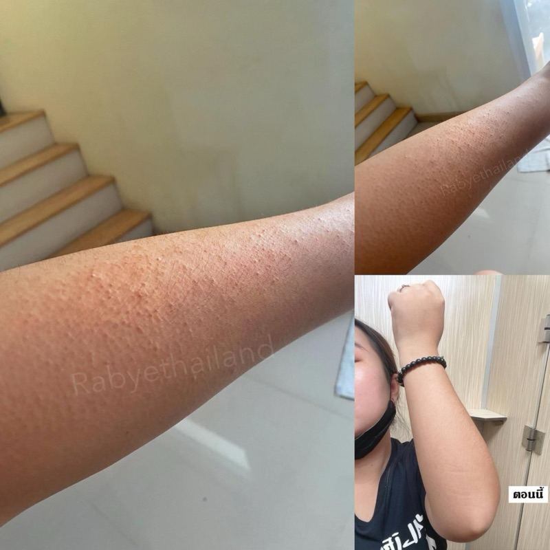 RABYE Honey Milk Protein ทรีทเม้นท์สำหรับผู้มีปัญหาขนคุด รอยดำ สมานผิว ลดการระคายเคือง - รูปที่ 5