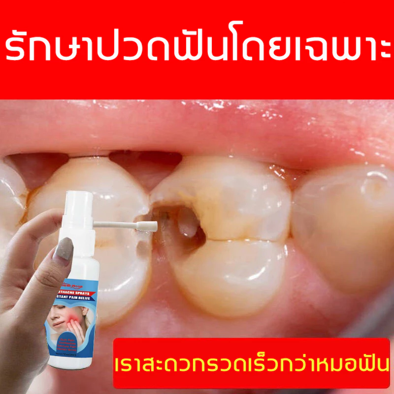 ยาพ่นแก้ปวดฟัน South Moon สเปรย์แก้ปวดฟัน แก้ปวดฟัน สารสกัดสมุนไพรจีน พบหมอฟันสิบครั้ง ฉีดครั้งเดียวดีกว่า สูตรธรรมชาติ