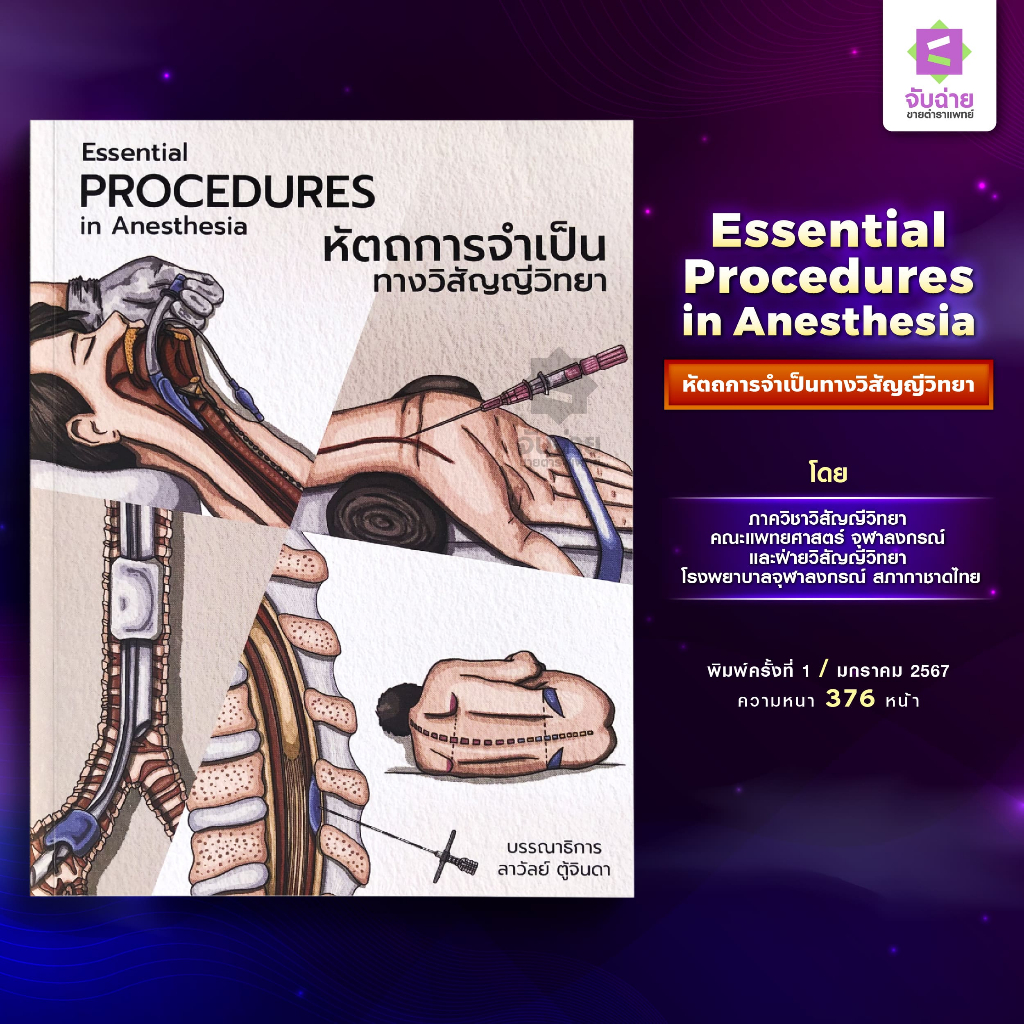 Essential Procedures in Anesthesia