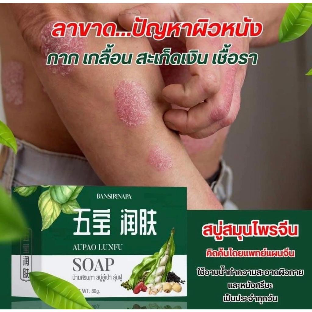 สบู่อู๋เป่า ลู่นฟู่ บ้านศิรินภา รักษาโรคเชื้อราบนผิวหนัง กลากเกลื้อน ลดอาการคัน ของแท้