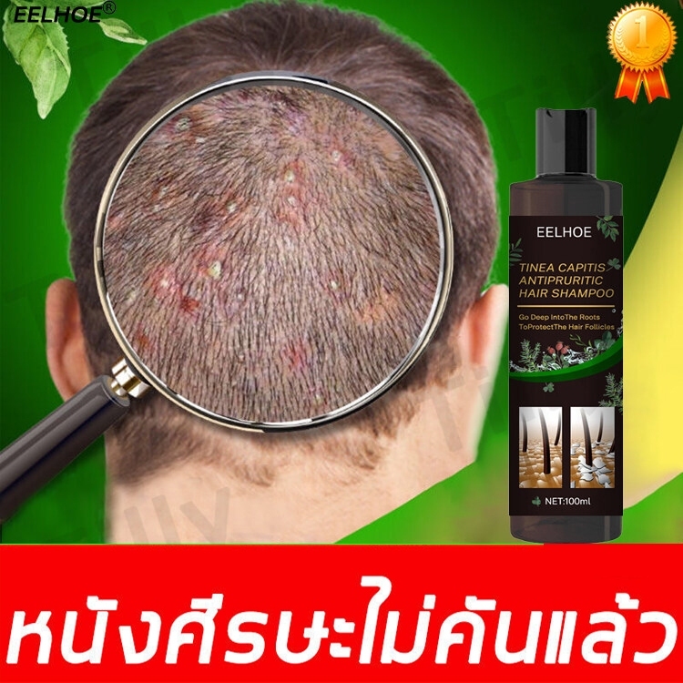 EELHOE 100ml แชมพูขจัดรังแค ขจัดรังแค หยุดอาการคัน ลดผมร่วง ยาสระผมเชื้อรา ยาสระผมขจัดรังแค แชมพูสมุนไพรยาสระผม