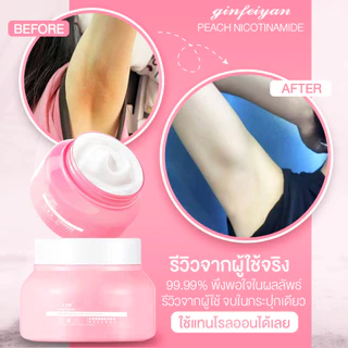 ครีมทากู้รักแร้ ดำหนีบดำ ลดตุ่มหนังไก่ ปริมาณ 250 กรัม