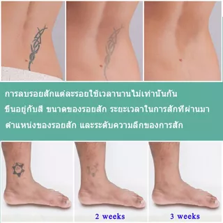 【ไม่ทิ้งรอยแผลเป็น】ครีมลบล้างรอยสัก ซึมซาบเข้าสู่ผิวได้อย่างรวดเร็ว ละลายเม็ดสี และซ่อมแซมผิว（สูตรพืชธรรมชาติ ที่ลบรอยสั