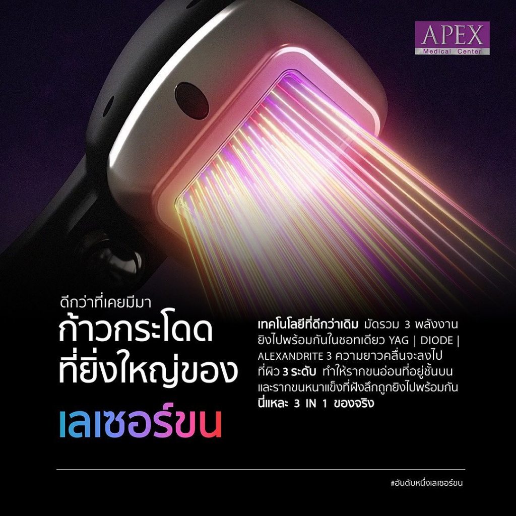 [E-Voucher] APEX เลเซอร์ขนหน้า ทั่วหน้า หนวด เครา คาง  ราคาพิเศษเฉพาะทดลอง 1 ครั้ง