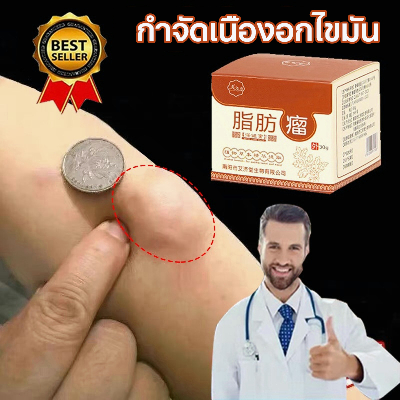 กำจัดเม็ดไขมัน ครีมทาก้อนเนื้องอกไขมัน ครีมกำจัดก้อนซีส30g กำจัดก้อนไขมันใต้ผิวหนังอย่างปลอดภัยไม่เจ็บ