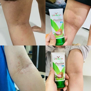 ยางนา - ของแท้ โลชั่นน้ำมันมะพร้าวสกัดเย็น 90 มล. โลชั่นบำรุงผิว ผด ผื่นคัน ผิวแตก รอยดำ ผิวแห้ง ยุง