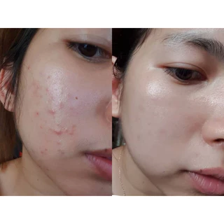 เซรั่มหน้าลอยทิพย์สุ40มล.Niacinamide(จำกัด300ขวดเท่านั้น)THIPS เซรั่มลูกคนหนู skinเซรั่ม บำรุง ผิวหน้า Skincare