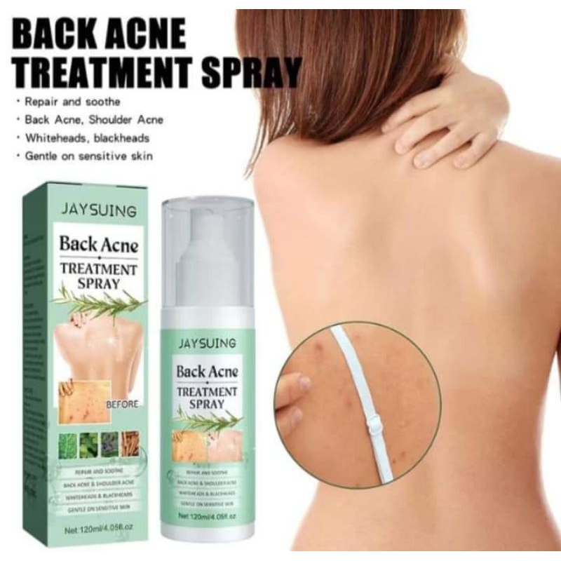 Jaysuing Back Acne Treatment Spray 120ml