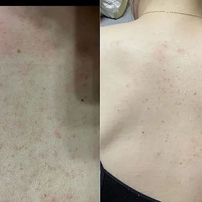 (🌼แท้ / พร้อมส่ง🌼) Kopher Absobent Body Beads 200 ml เจลอาบน้ำมอยส์เจอร์ไรเซอร์