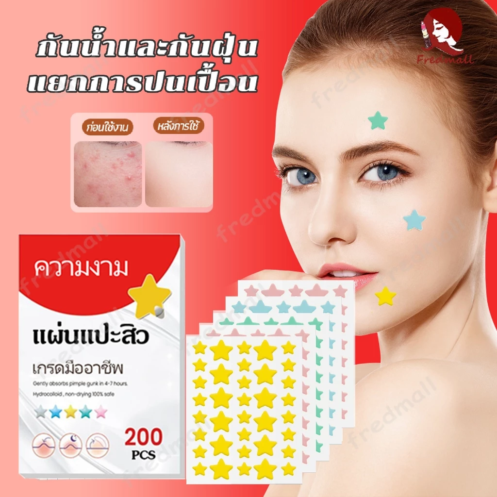 แผ่นแปะสิว แผ่นแปะดูดสิว แผ่นสติกเกอร์แปะสิว แผ่นสิว สําหรับติดตกแต่งสิว 200ชิ้น/ถุง รูปดาวน่ารัก