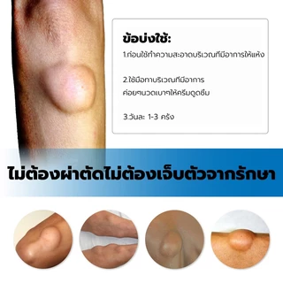 🔥ขายดี แท้ OUHOE🔥 ครีมทา ซี ส ก้อนไขมัน พร้อมส่งทั่ว ส่งไว ส่งฟรี