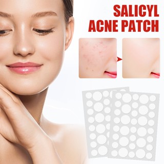 [Teybren]แผ่นแปะสิว ช่วยลดอาการอักเสบให้ยุบไว ช่วยดูดสิว รัก…