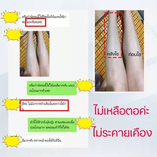 ครีมขจัดขนน้องสาว กำจัดขน แว็กขน กำจัดขนรักแร้ กำจัดขนที่ลับ อ่อนโยนต่อผิว ไม่เหลือตอ กำจัดขนจุดซ่อนเร้นถาวร น้องสาวเนี