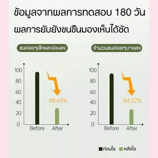 ครีมขจัดขนน้องสาว กำจัดขน แว็กขน กำจัดขนรักแร้ กำจัดขนที่ลับ อ่อนโยนต่อผิว ไม่เหลือตอ กำจัดขนจุดซ่อนเร้นถาวร น้องสาวเนี