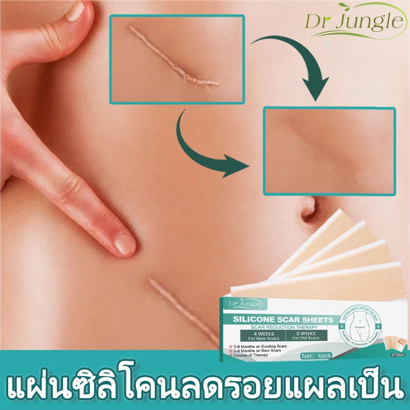จัดส่งที่รวดเร็ว Dr.JUNGLE แผ่นแปะรอยแผลเป็น รักษารอยแผลเป็น 4แผ่น/กล่อง ลบรอยแผลเป็นแผลผ่าตัด เผยผิวเนียนสวย