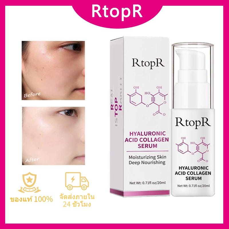 RtopR FDA เซรัมบํารุงผิวหน้าหน้าเนียนใส อิ่มฟู ดูสุขภาพดี สูตรคอลลาเจน  Collagen Whitenin  Facial Se