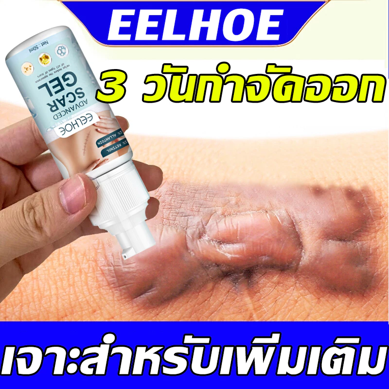 EELHOE ครีมทารอยแผลเป็น50ML รักษารอยแผลเป็น แผลผ่าตัด ทาแผลเป็น ทาแผลเป็นนูน ครีมทาแผลเป็น ครีมลบแผลเป็น