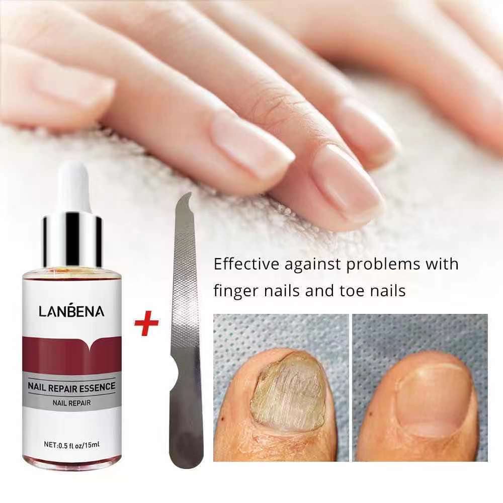 LANBENA เซรั่มบำรุงเล็บ น้ำยาบำรุงเล็บ 15ml บำรุงเล็บ ต่อต้านการติตเชื้อรา ซ่อมแซมเล็บแตก เล็บเปราะ