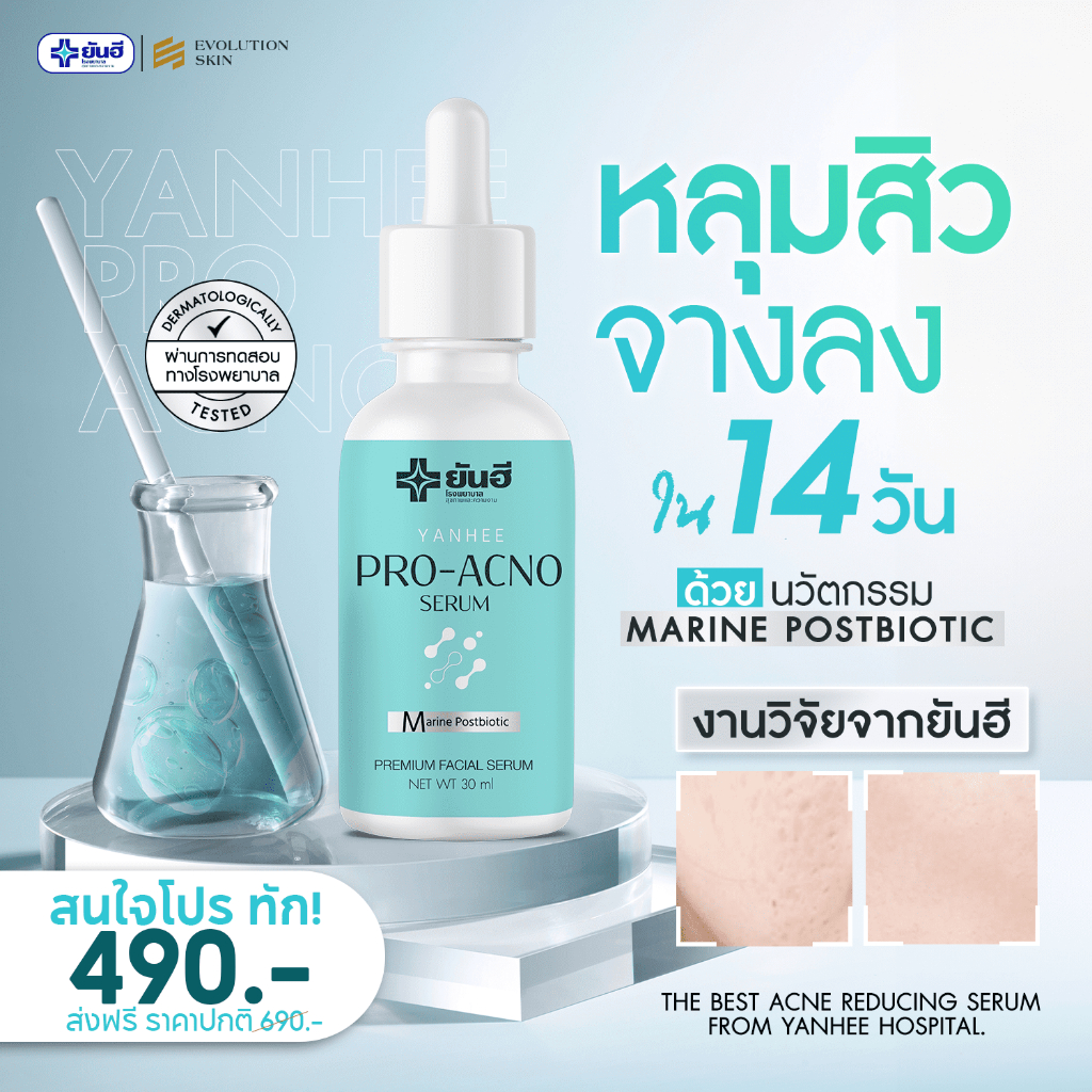 [ สั่งผ่าน VDO ลด 30-50% ] โปรเอกโน่ จัดการหลุมสิว ลดสิว คุมมันให้ความชุมชื้น [ เซรั่มยันฮี ]
