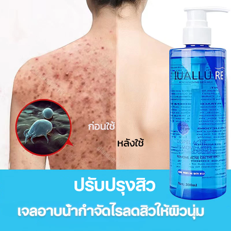 Body wash ครีมอาบน้ำ ครีมอาบน้ำลดสิว 300ml ต่อต้านเชื้อราแก้คัน ให้ความชุ่มชื้นอ่อนโยน กลิ่นหอมติดทน ลดสิว กำจัดไร คุมน้