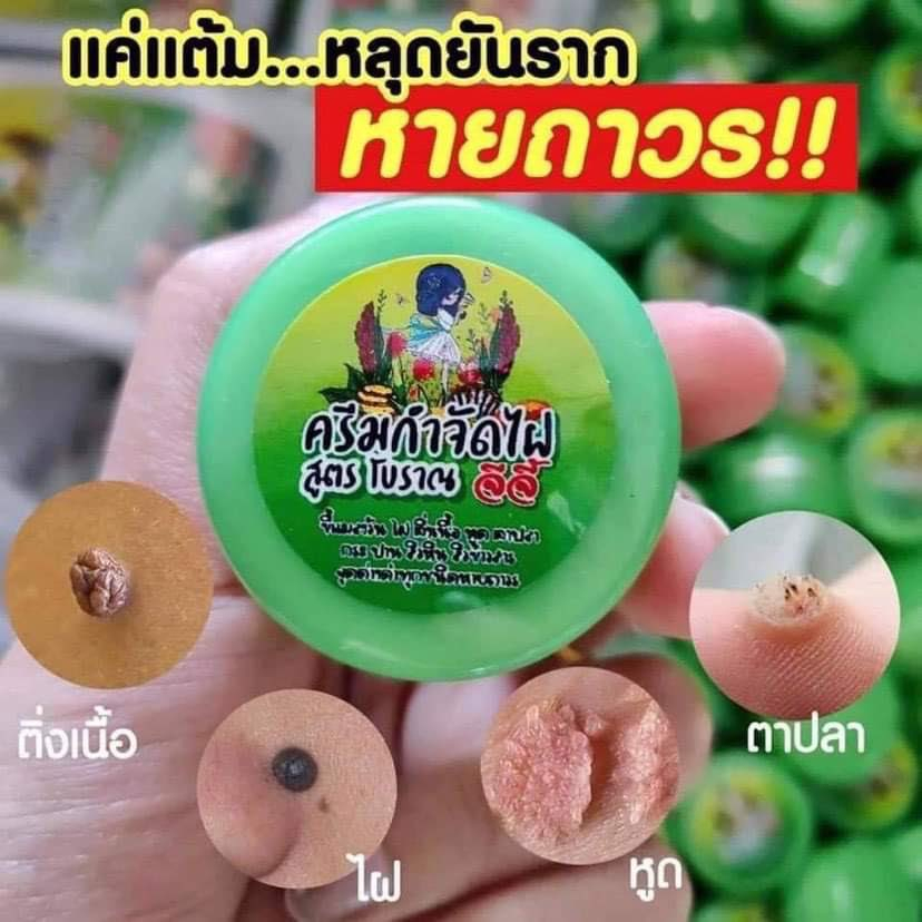 ผลิตภัณฑ์ ไฝ ขี้แมลงวัน หูดตาปลาและติ่งเนื้อ ของแท้ ❤ พร้อมส่ง ไฝ จีจี้ ❗ ไฝ แต้ม ทาไฝ ทาขี้แมลงวัน 1109