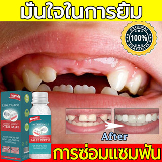 🦷ทันตกรรม ฟันปลอม ซิลิโคน ปลอดภัยไร้สารพิษ ทดแทนฟันที่หายไป ไม่หลุด อุดฟัน กาวติดฟันปลอม ฟันปลอม ชุดซ่อมฟันชุดทำฟันปลอม