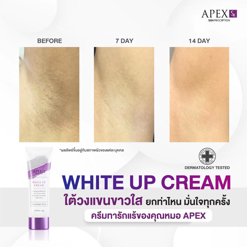 APEX-SX WHITE UP CREAM ครีมทารักแร้ขาว โดยแพทย์ผิวหนังเอเพ็กซ์ ทาขาหนีบดำ แก้มก้นดำ 50 ml. thumbnail 4