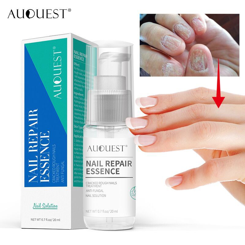 AuQuest ยาทาเล็บ เอ็สเซ้นซ่อมแซมเล็บเสีย รักษาโรคเชื้อราที่เล็บ เล็บไม่เรียบ เล็บแตก เล็บไม่แตกอีก เล็บเปราะ 20ml