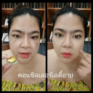 คอลซิลเลอร์เลดี้อายครีม