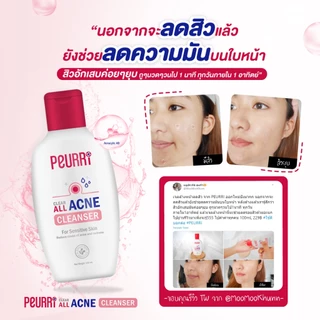 PEURRi Acne Cleanser เจลล้างหน้าสำหรับคนเป็นสิว 250ml.