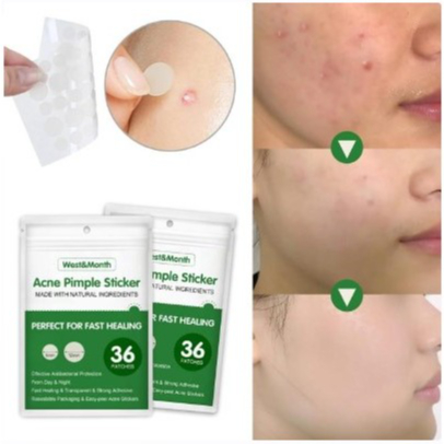 West month acne pimple sticker แผ่นแปะรักษาสิว
