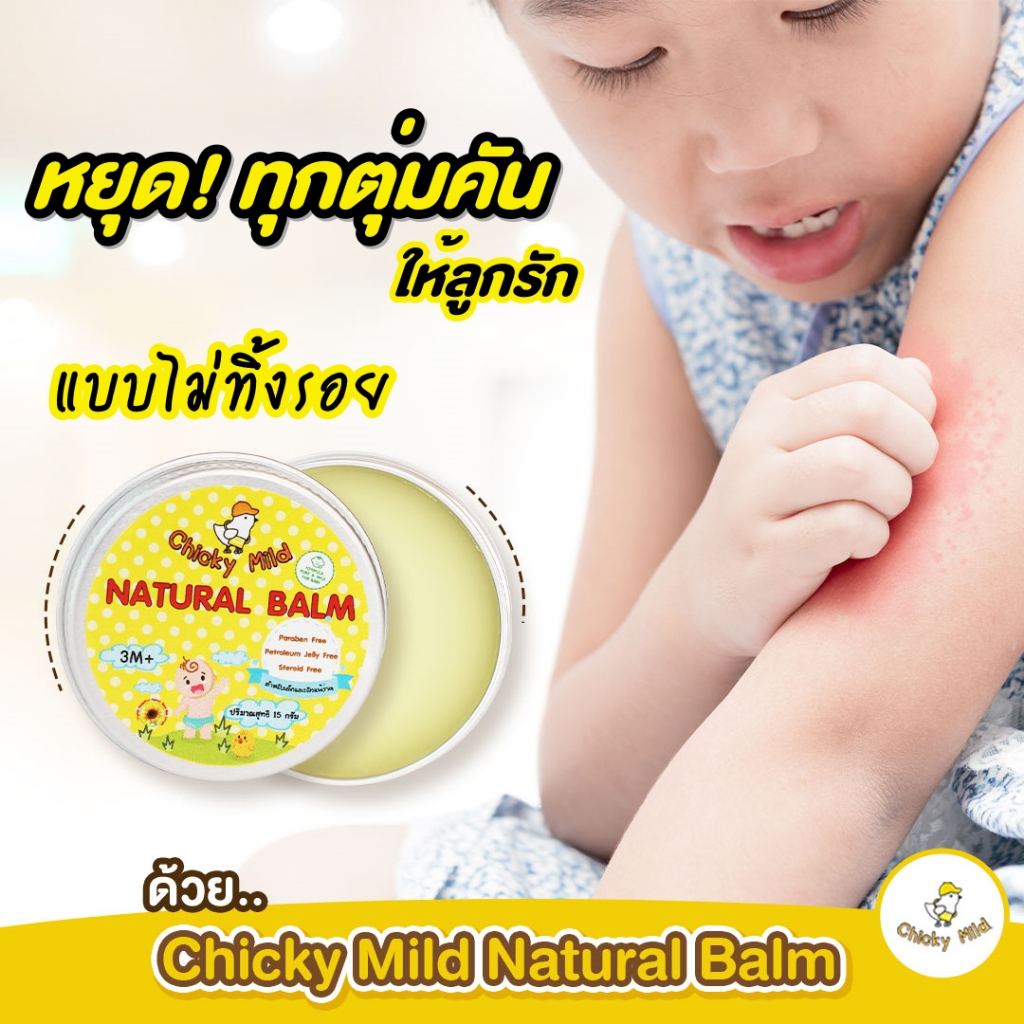 บาล์มทายุงกัด Chicky Mild 15 กรัม ลดคัน ลดบวม ไม่ทิ้งรอยดำ ทาหน้าได้ แก้แพ้ยุง ผื่นแพ้คัน ไม่แสบร้อน