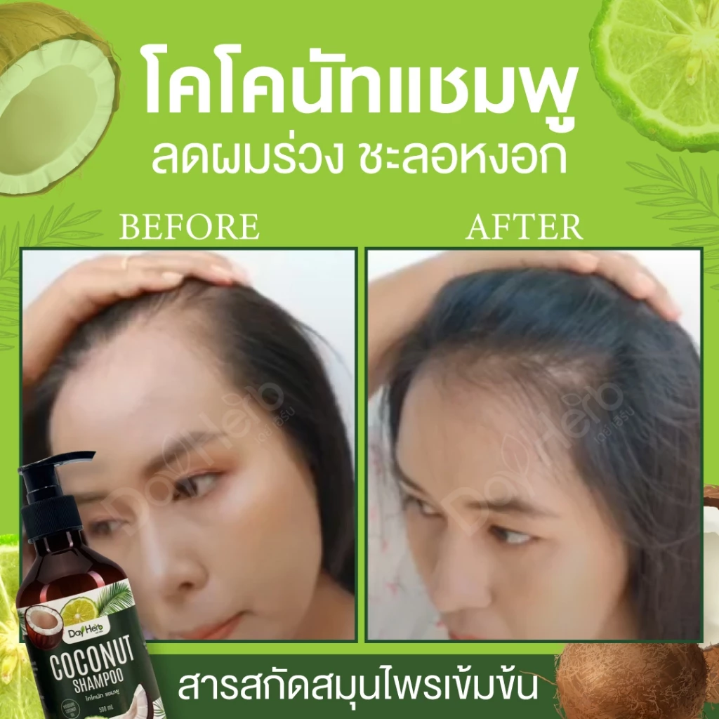 แชมพูมะพร้าว เดย์เฮิร์บ ลด ผมร่วง ผมบาง thumbnail 6